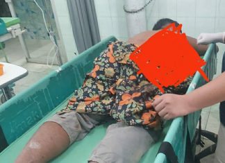 Ardianto Koban Penembakan Masih Terbaring Lemah di Rumah Sakit