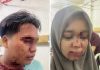 Pelemparan Batu Terhadap Pendukung Paslon 01 Diduga oleh Tiga Oknum Preman dari Bedaro
